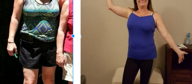 Brenda's Amazing Anti-Aging & Wellness Progress Photos